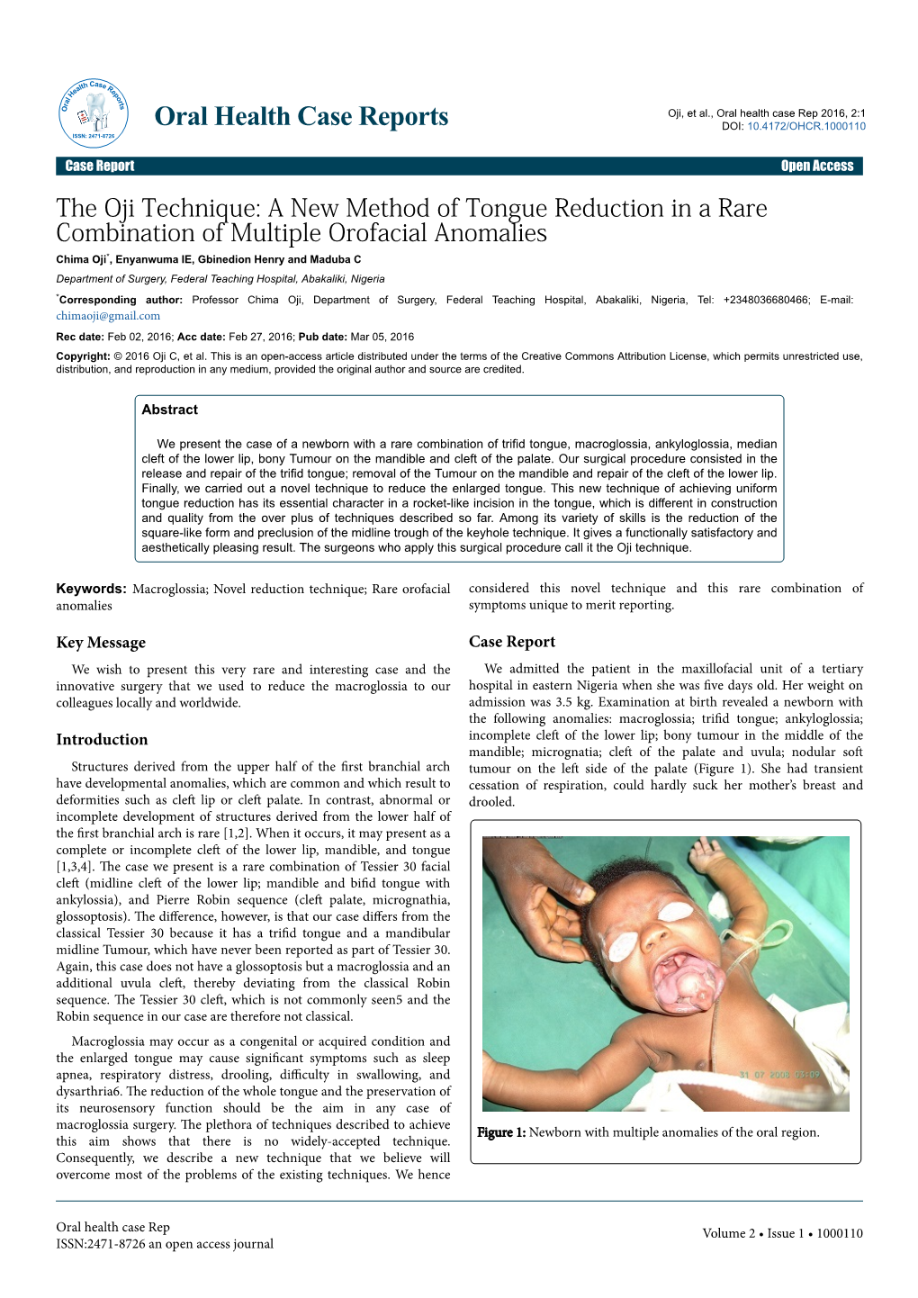 The Oji Technique: a New Method of Tongue Reduction in a Rare