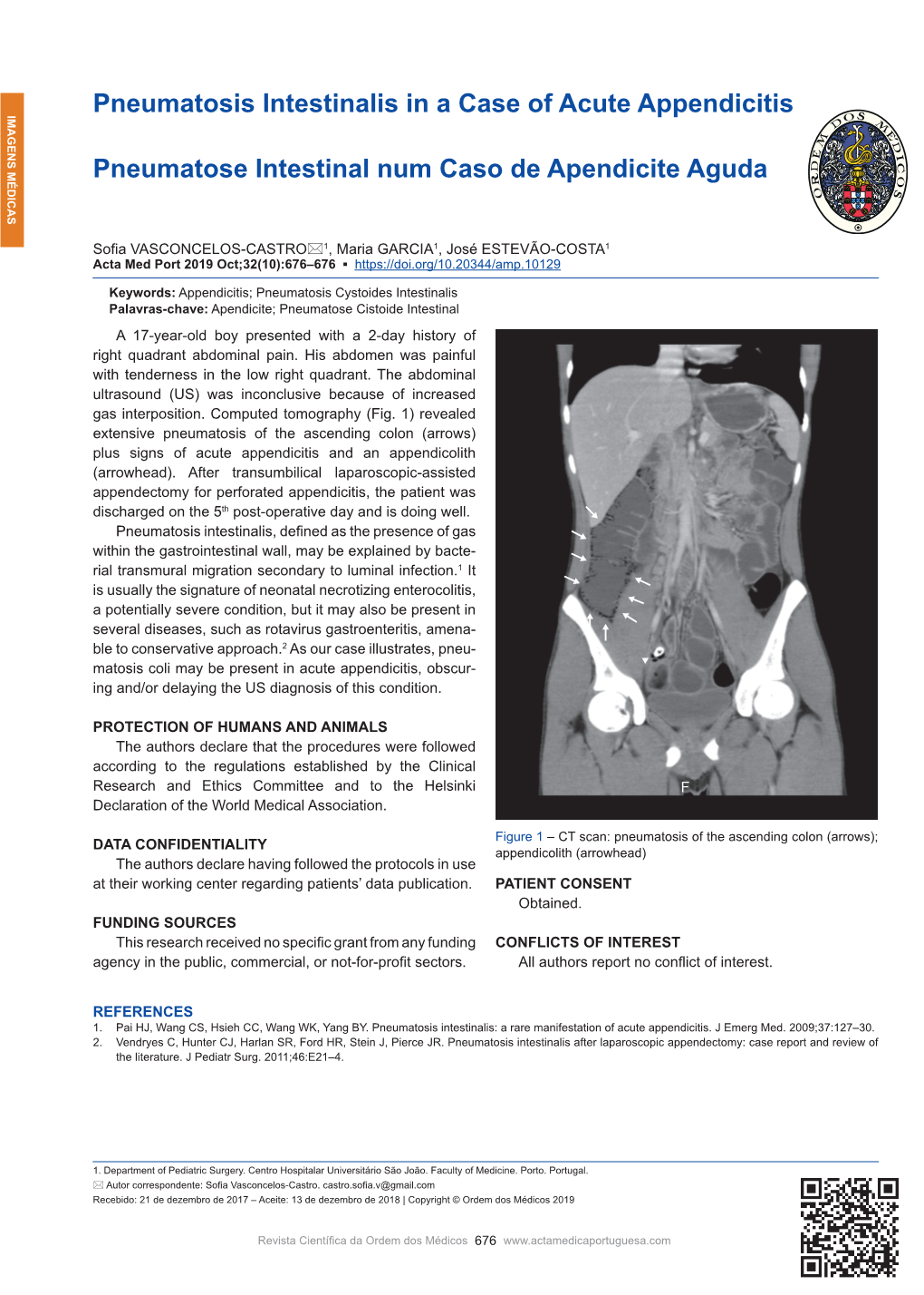 Pneumatosis Intestinalis in a Case of Acute Appendicitis Pneumatose