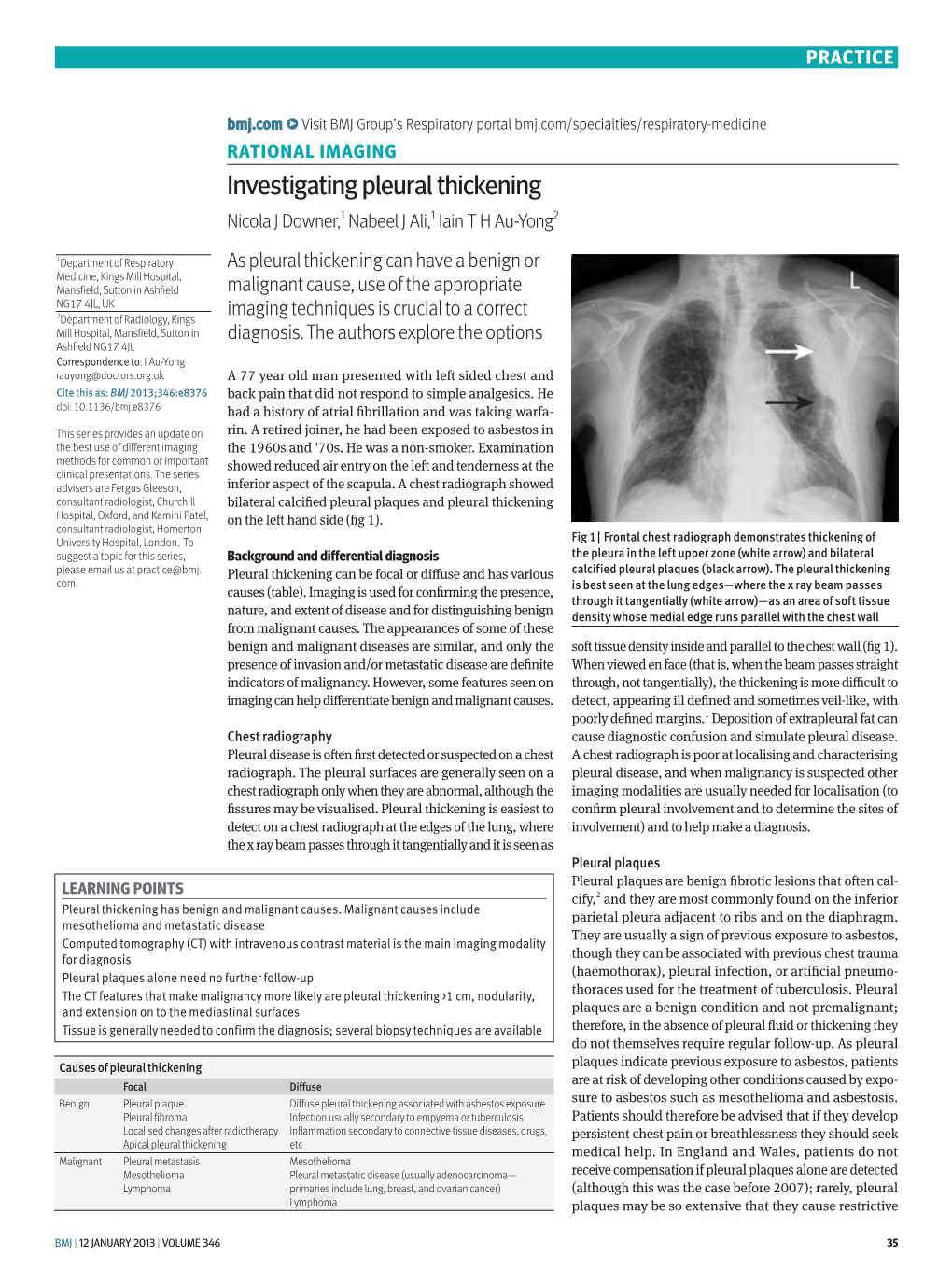 Investigating Pleural Thickening Nicola J Downer,1 Nabeel J Ali,1 Iain T H Au-Yong2