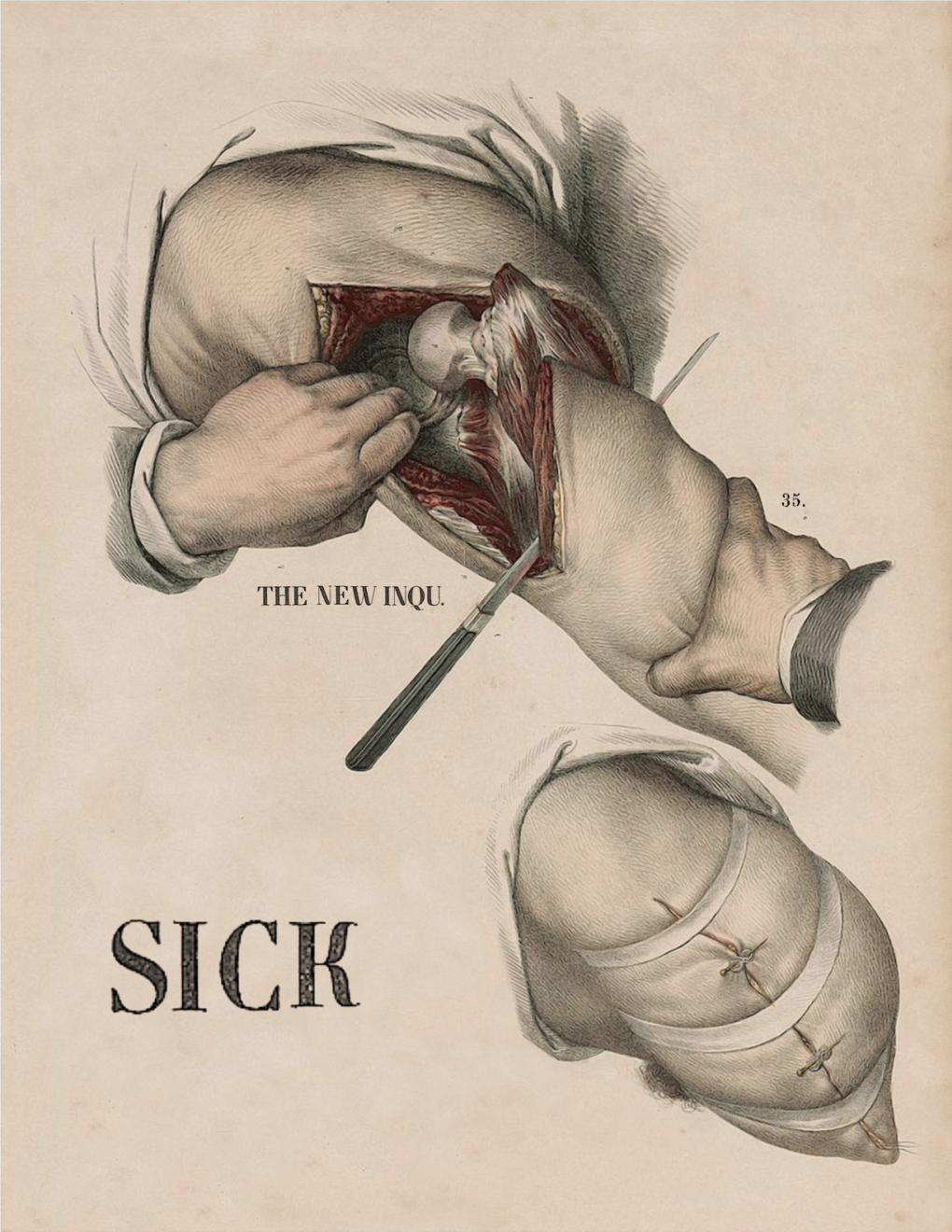 Sickness Unto Death Derek Ayeh Reviews Atul Gawande’S Being Mortal 50