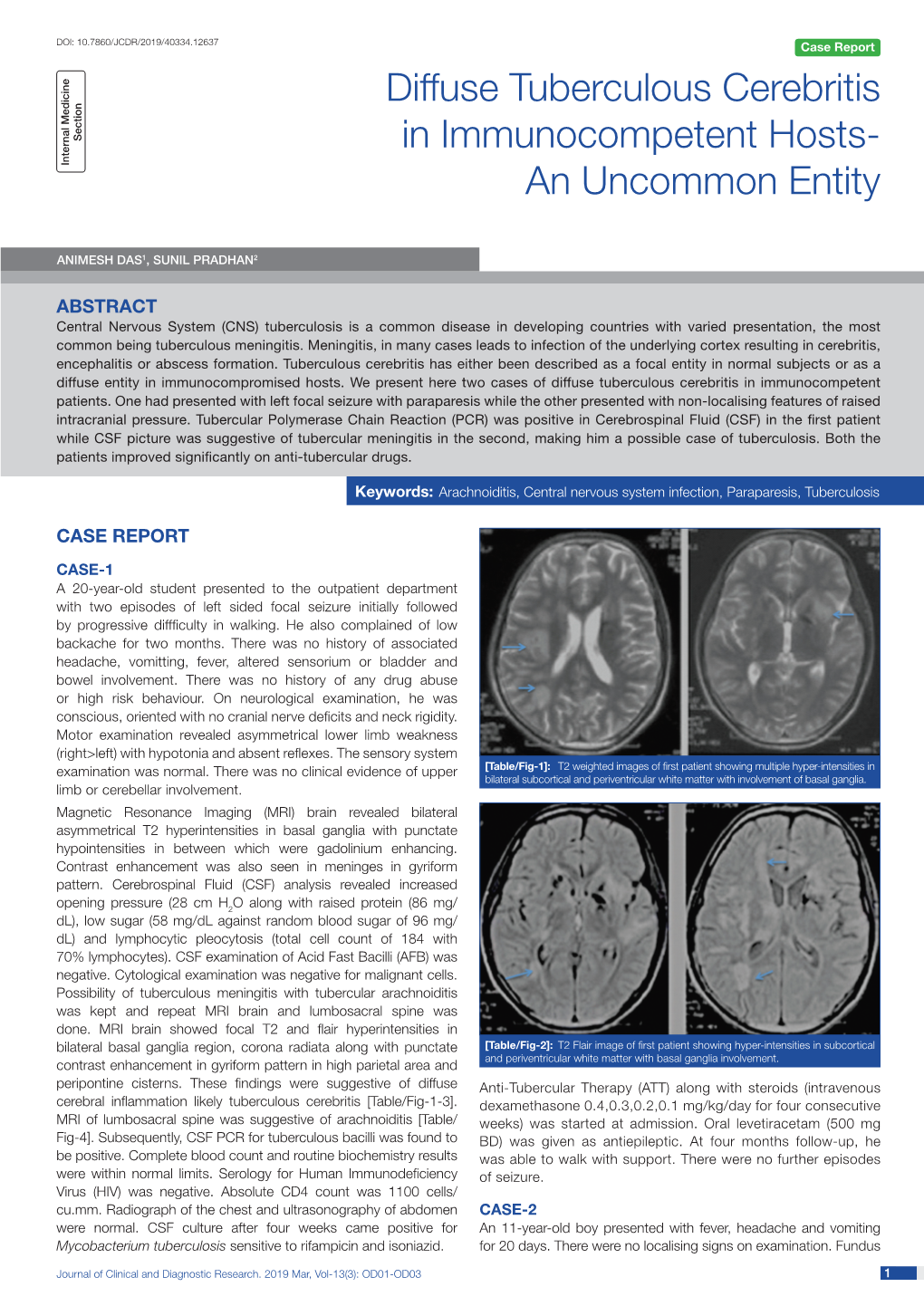 Diffuse Tuberculous Cerebritis in Immunocompetent Hosts- an Undescribed Entity