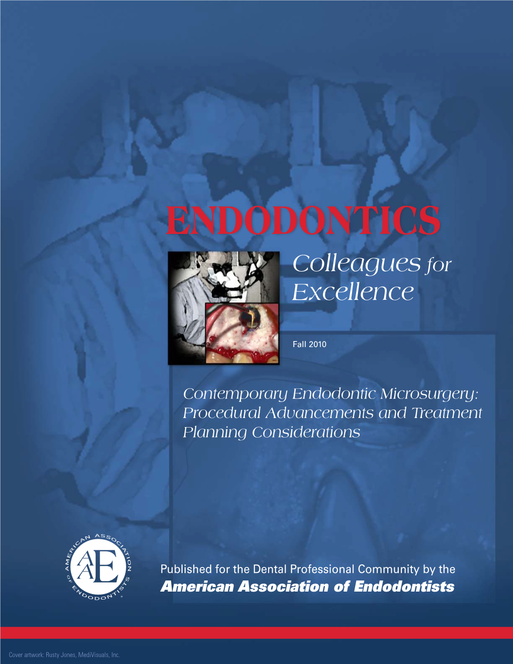 Contemporary Endodontic Microsurgery