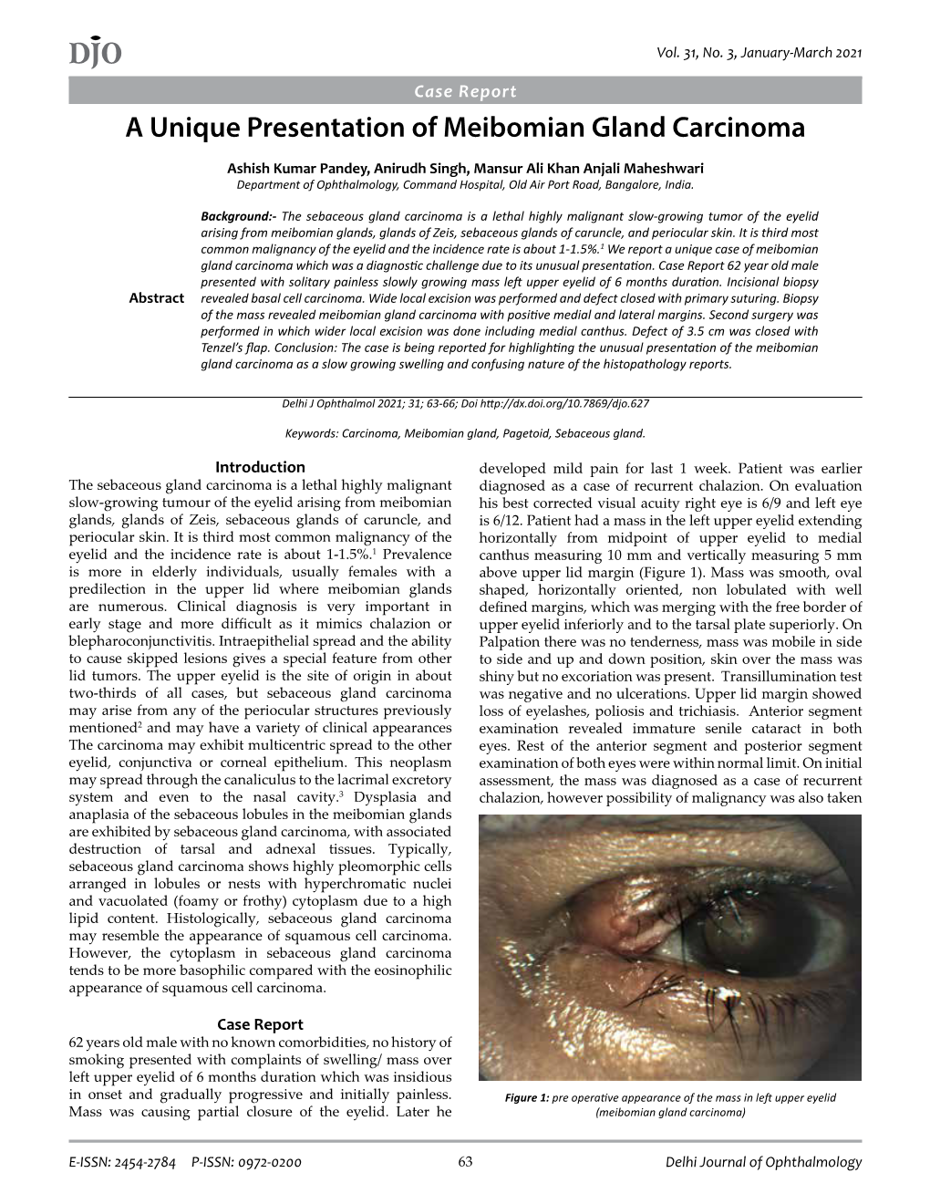 DJO a Unique Presentation of Meibomian Gland Carcinoma