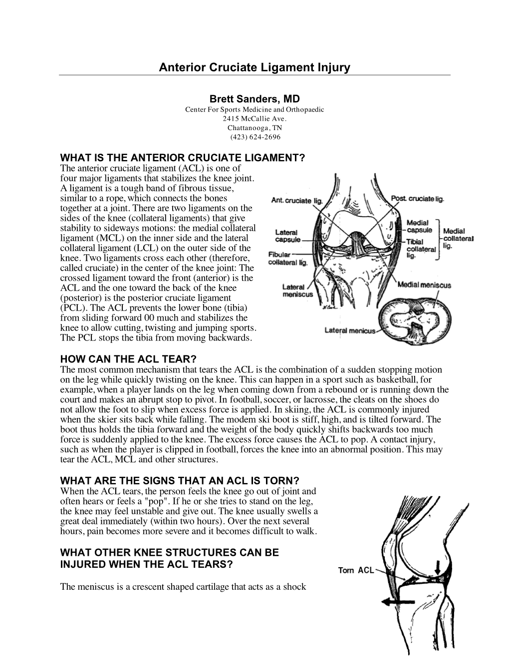 Anterior Cruciate Ligament Injury