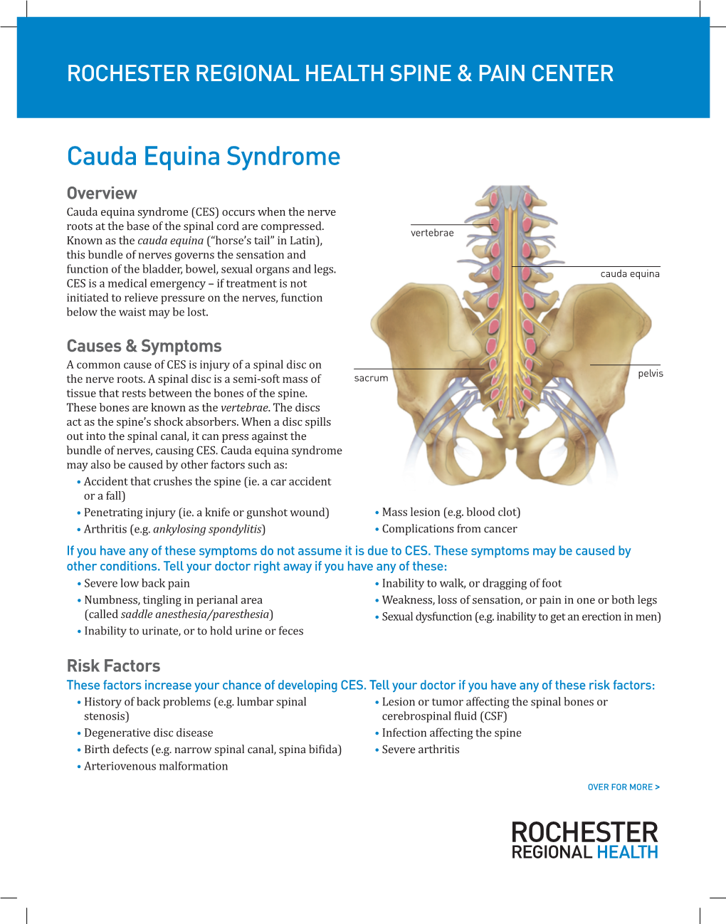 Cauda Equina Syndrome Overview Cauda Equina Syndrome (CES) Occurs When the Nerve Roots at the Base of the Spinal Cord Are Compressed