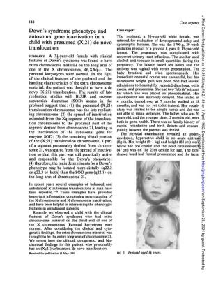 Down's Syndrome Phenotype and Autosomal Gene Inactivation in a Child with Presumed