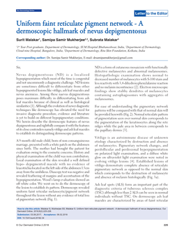 Uniform Faint Reticulate Pigment Network - a Dermoscopic Hallmark of Nevus Depigmentosus