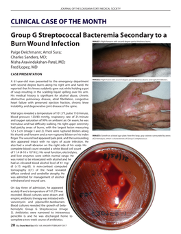 Group G Streptococcal Bacteremia Secondary to a Burn Wound Infection IMAGE 1: Right Forearm with Second Degree Partial Thickness Burns