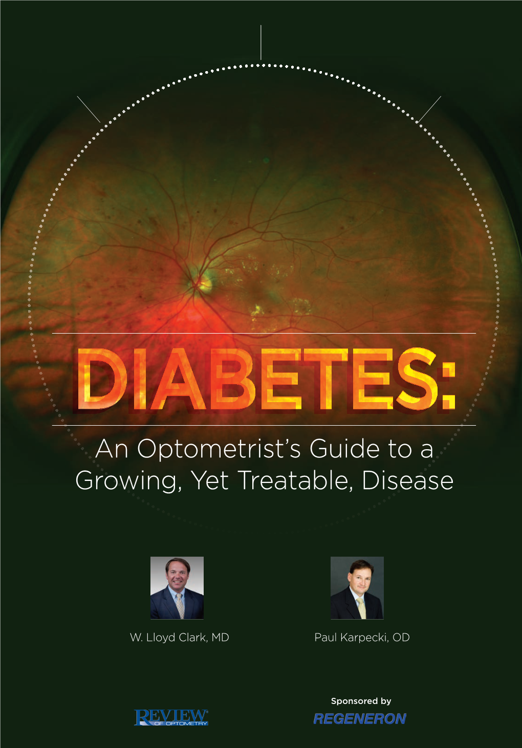 An Optometrist's Guide to a Growing, Yet Treatable, Disease