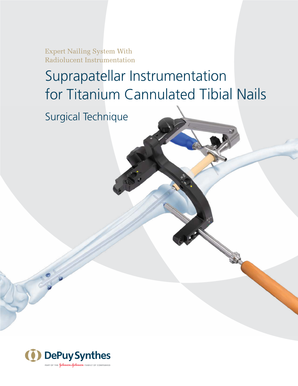 Suprapatellar Instrumentation for Titanium Cannulated Tibial Nails Surgical Technique TABLE of CONTENTS