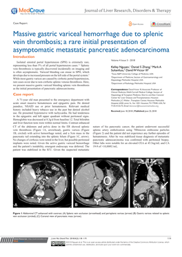Massive Gastric Variceal Hemorrhage Due to Splenic Vein Thrombosis