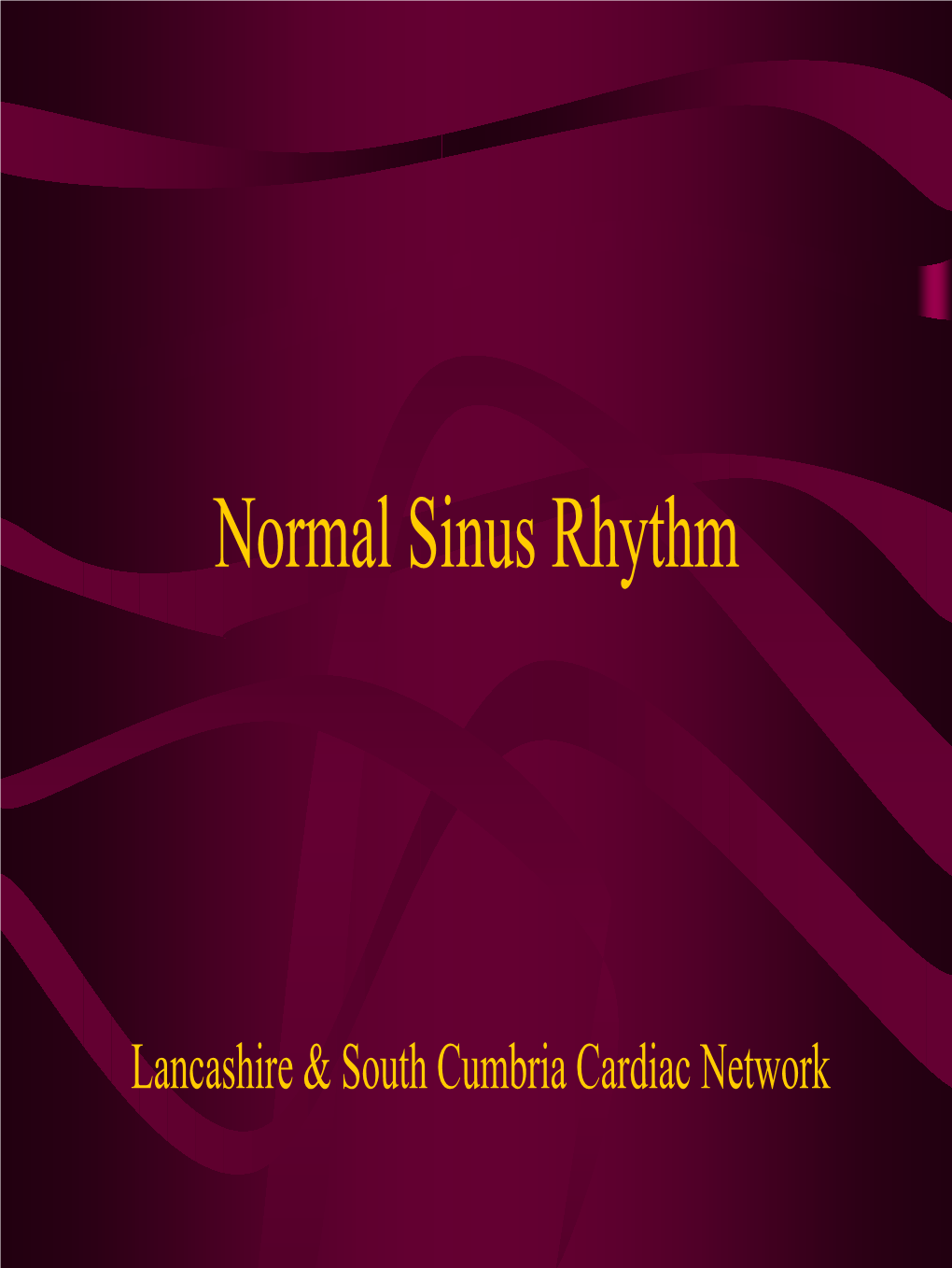 Normal Sinus Rhythm