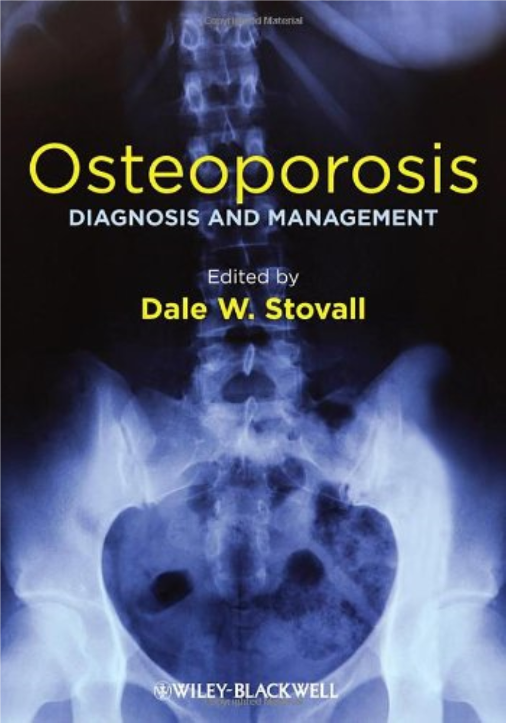 Osteoporosis Osteoporosis Diagnosis and Management