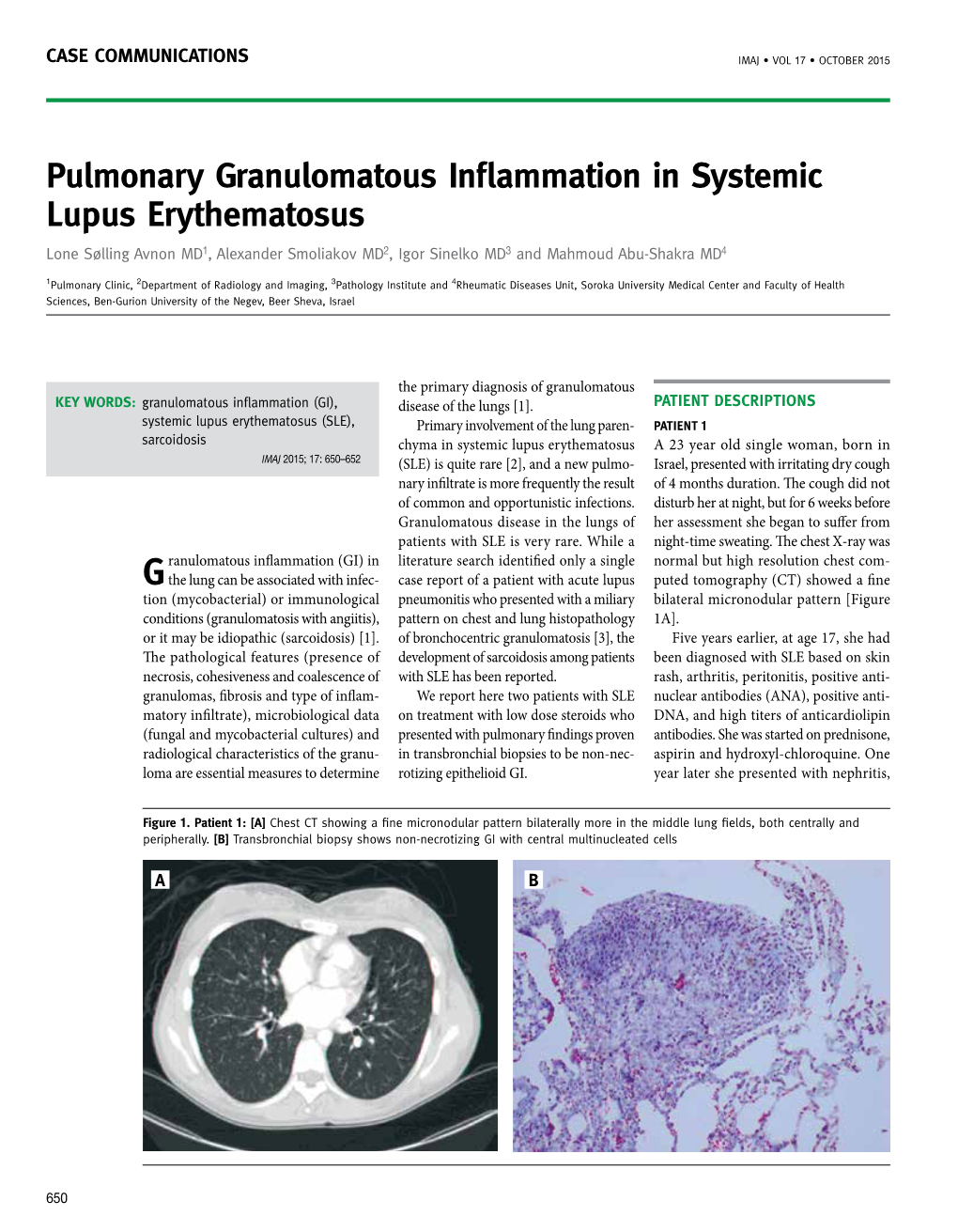 Pulmonary Granulomatous Inflammation in Systemic Lupus Erythematosus