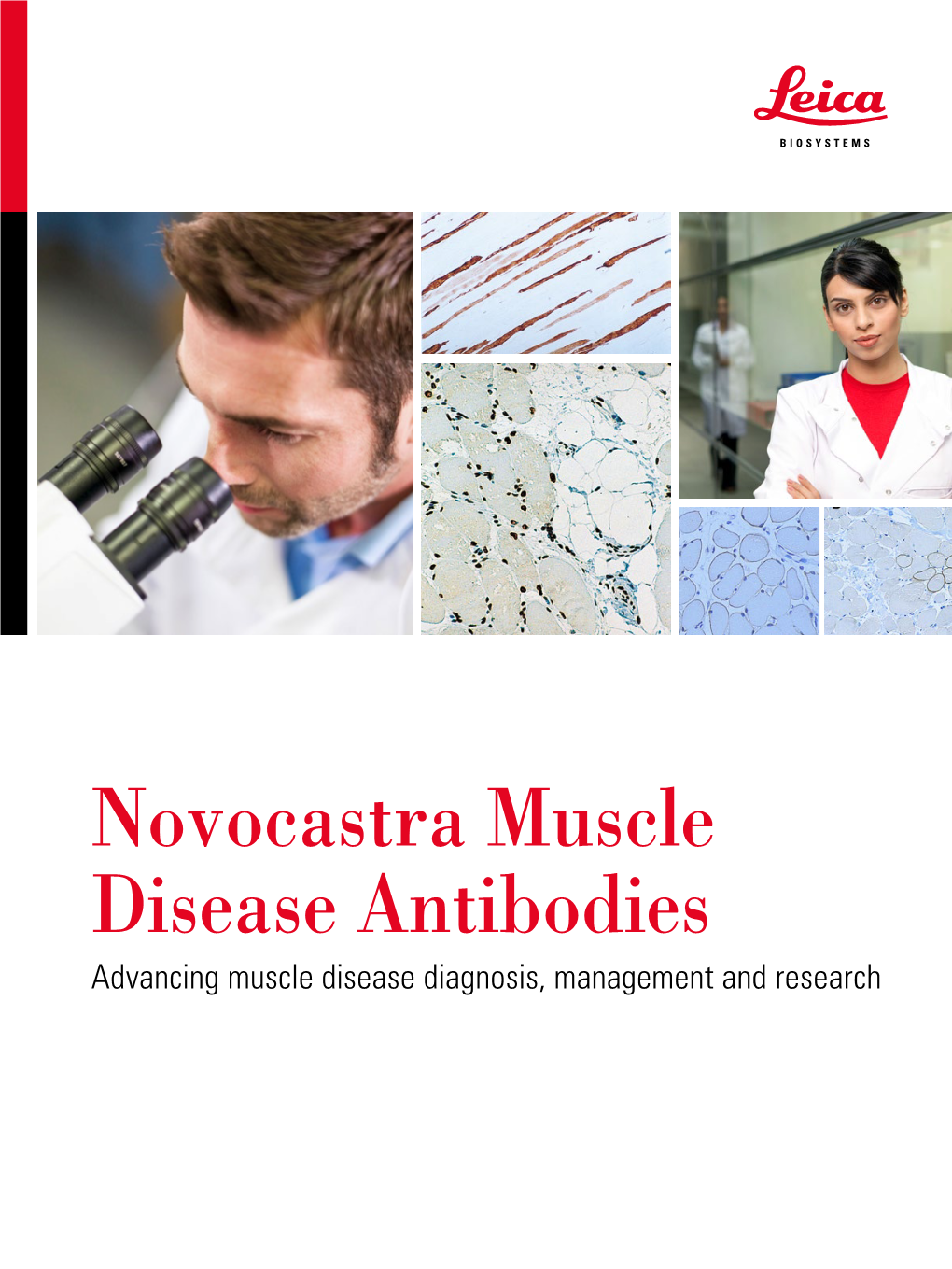 Novocastra Muscle Disease Antibodies Advancing Muscle Disease Diagnosis, Management and Research Novocastra Muscle Disease Antibodies