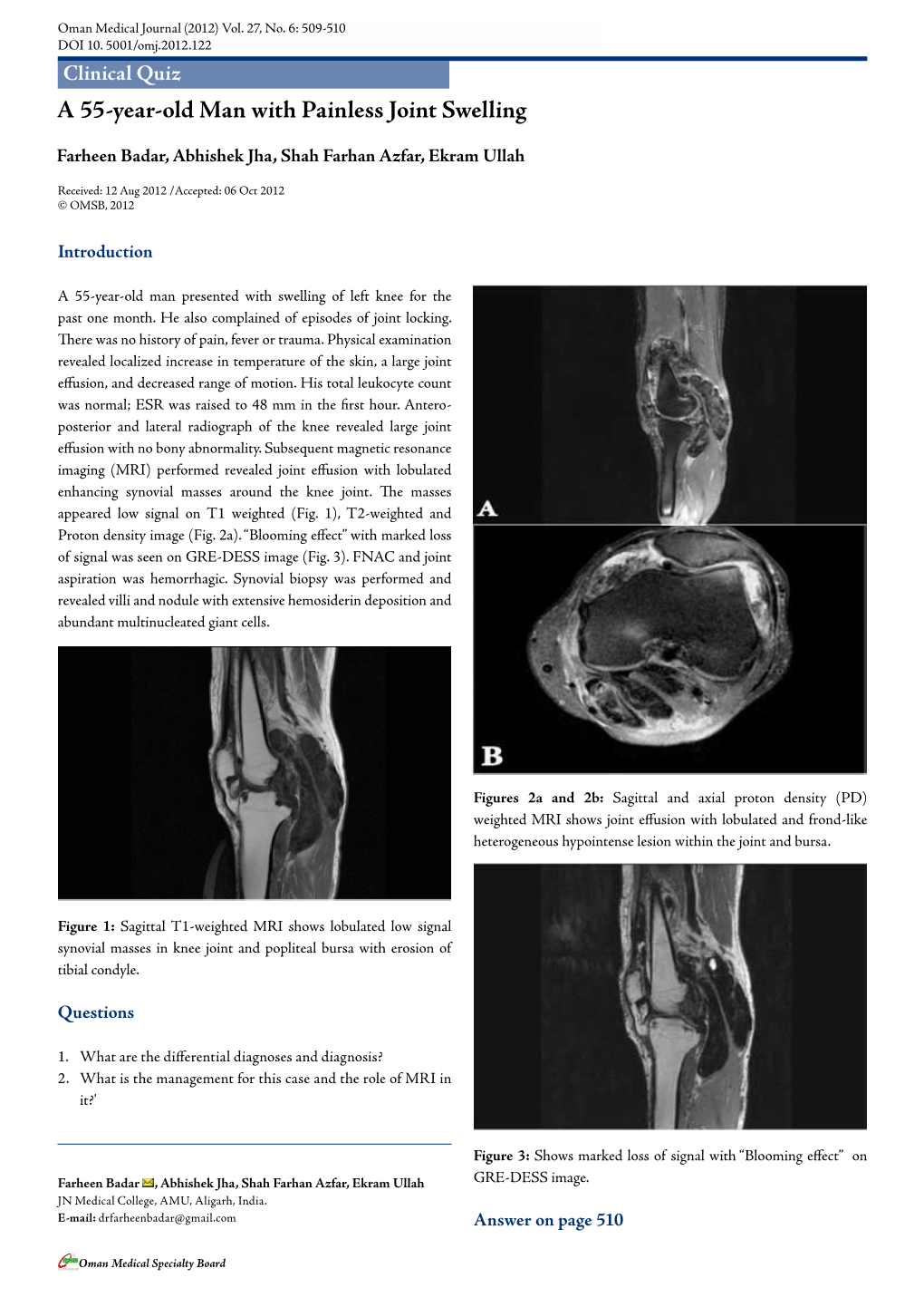 A 55-Year-Old Man with Painless Joint Swelling