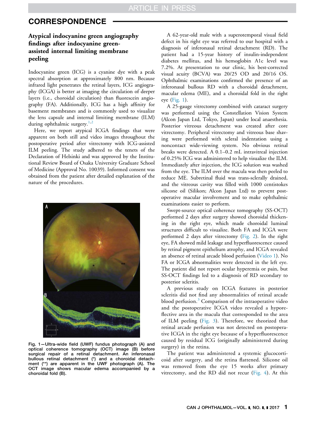 Atypical Indocyanine Green Angiography Findings After Indocyanine Green-Assisted Internal Limiting Membrane Peeling