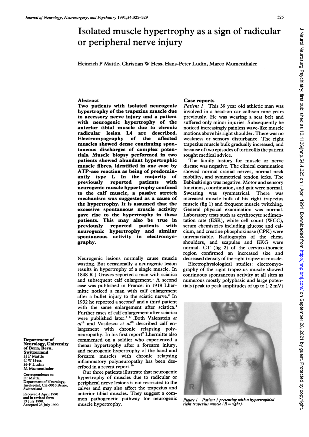 Isolated Muscle Hypertrophy As a Sign of Radicular Or Peripheral Nerve Injury