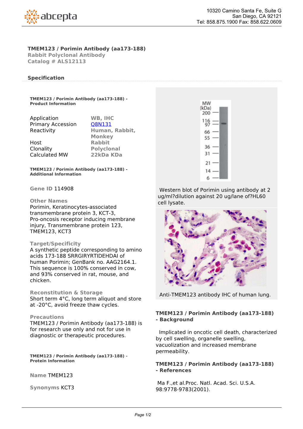 TMEM123 / Porimin Antibody (Aa173-188) Rabbit Polyclonal Antibody Catalog # ALS12113