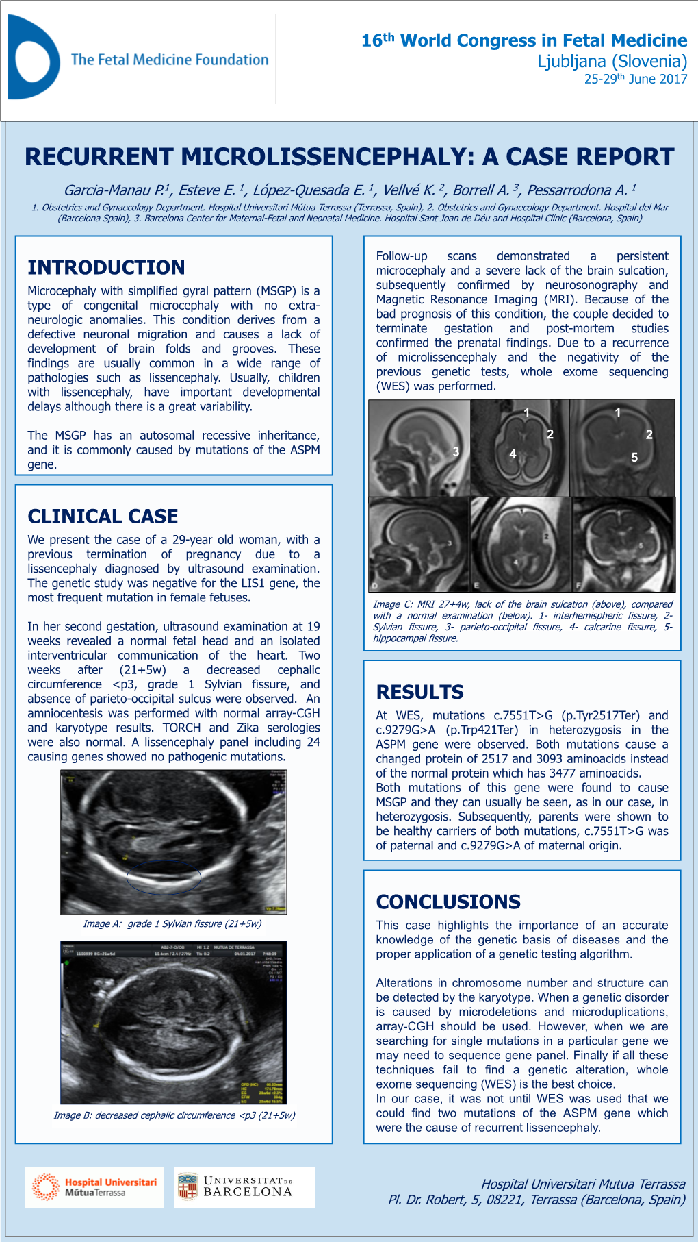 RECURRENT MICROLISSENCEPHALY: a CASE REPORT Garcia-Manau P.1, Esteve E