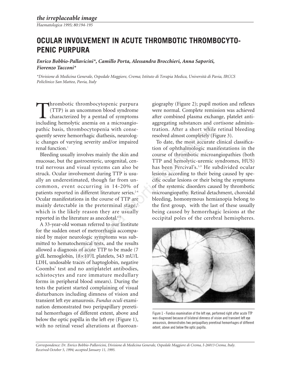 Ocular Involvement in Acute Thrombotic Thrombocyto