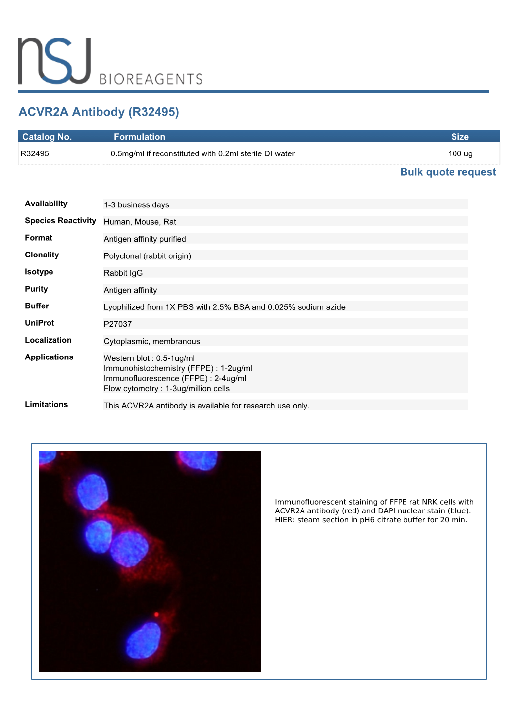 ACVR2A Antibody (R32495)