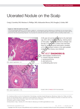 Ulcerated Nodule on the Scalp