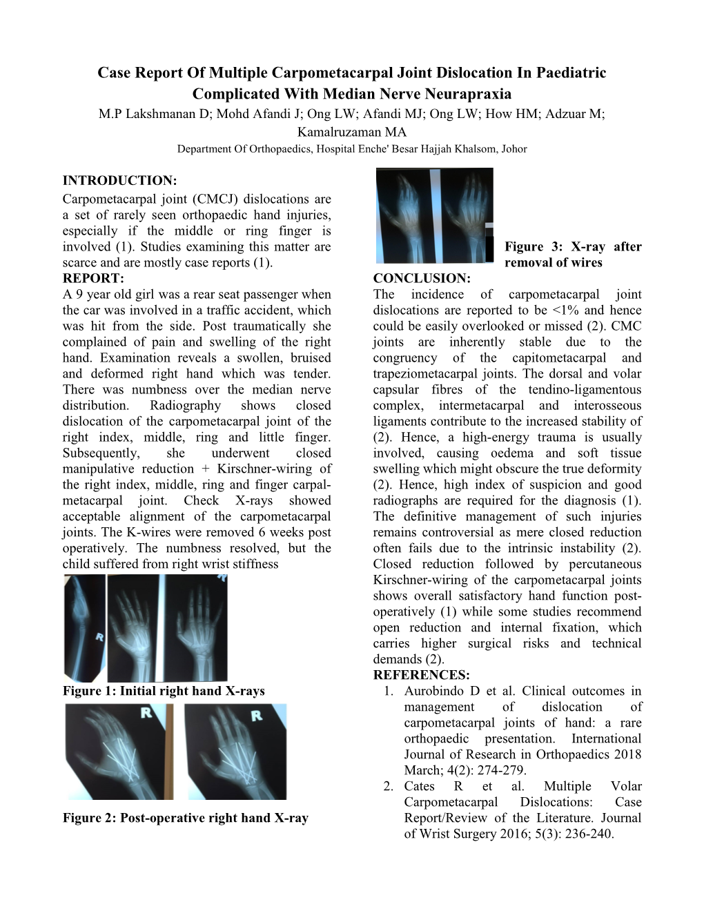 Case Report of Multiple Carpometacarpal Joint Dislocation