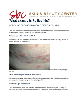 What Exactly Is Folliculitis?