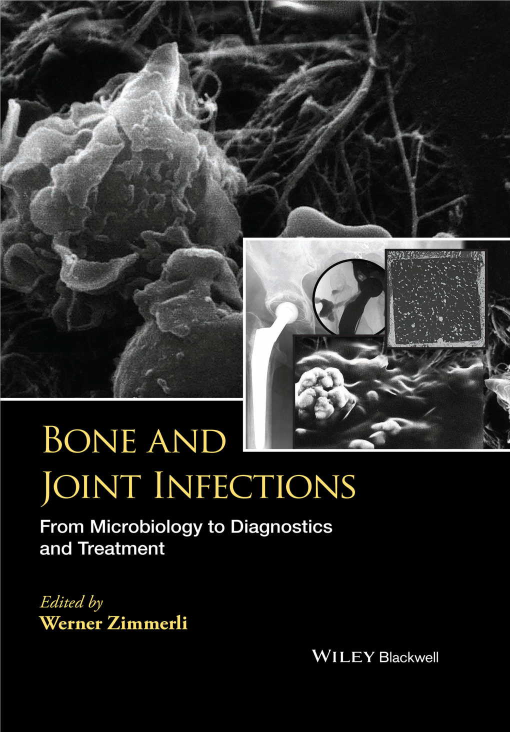 Bone and Joint Infections