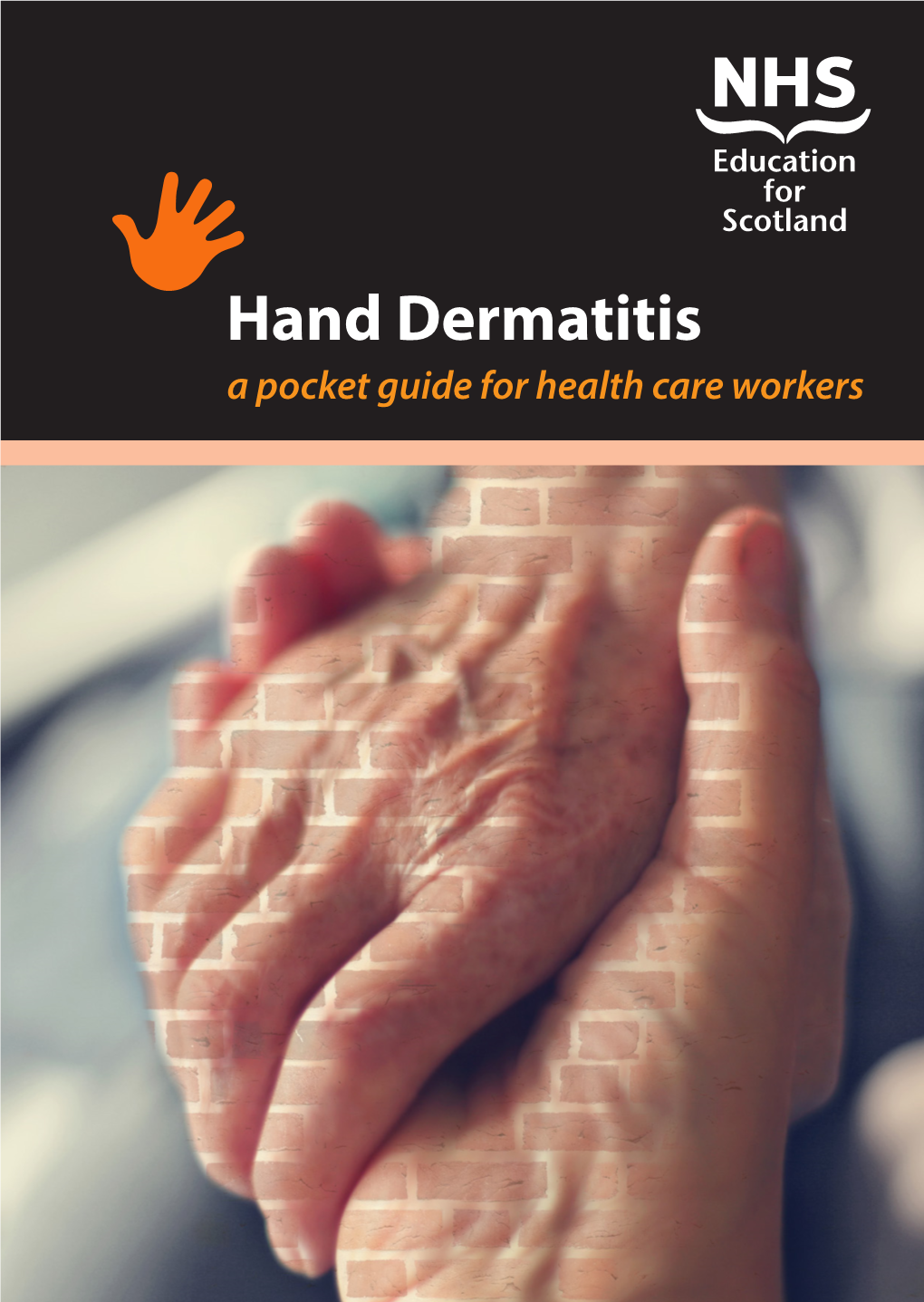 Hand Dermatitis Guide