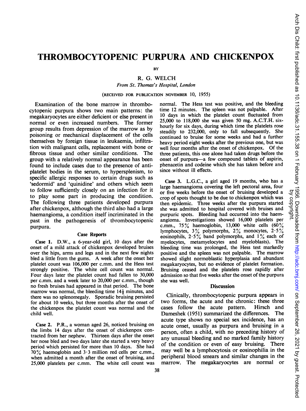 Thrombocytopenic Purpura and Chickenpox