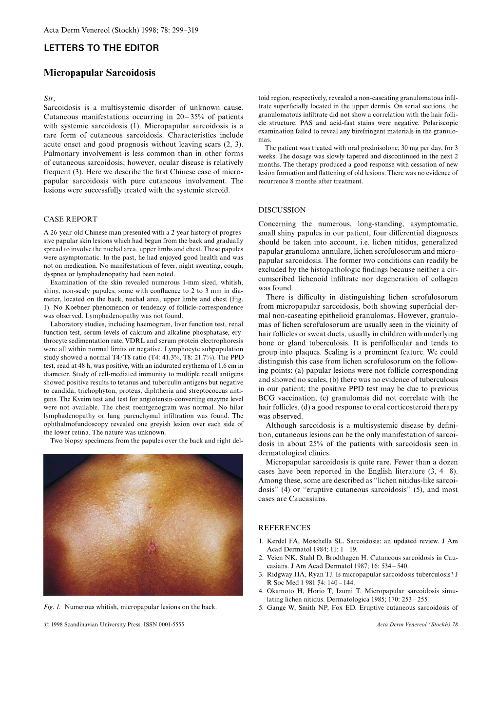 Micropapular Sarcoidosis