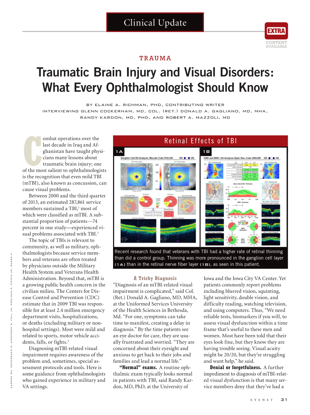 Traumatic Brain Injury and Visual Disorders: What Every Ophthalmologist Should Know