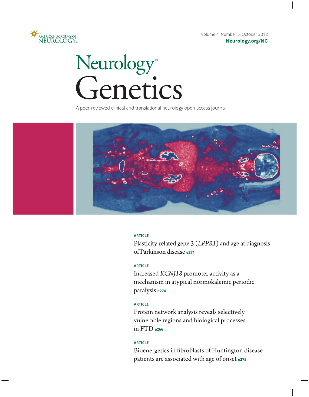 Plasticity-Related Gene 3 (LPPR1) and Age at Diagnosis of Parkinson Disease E271