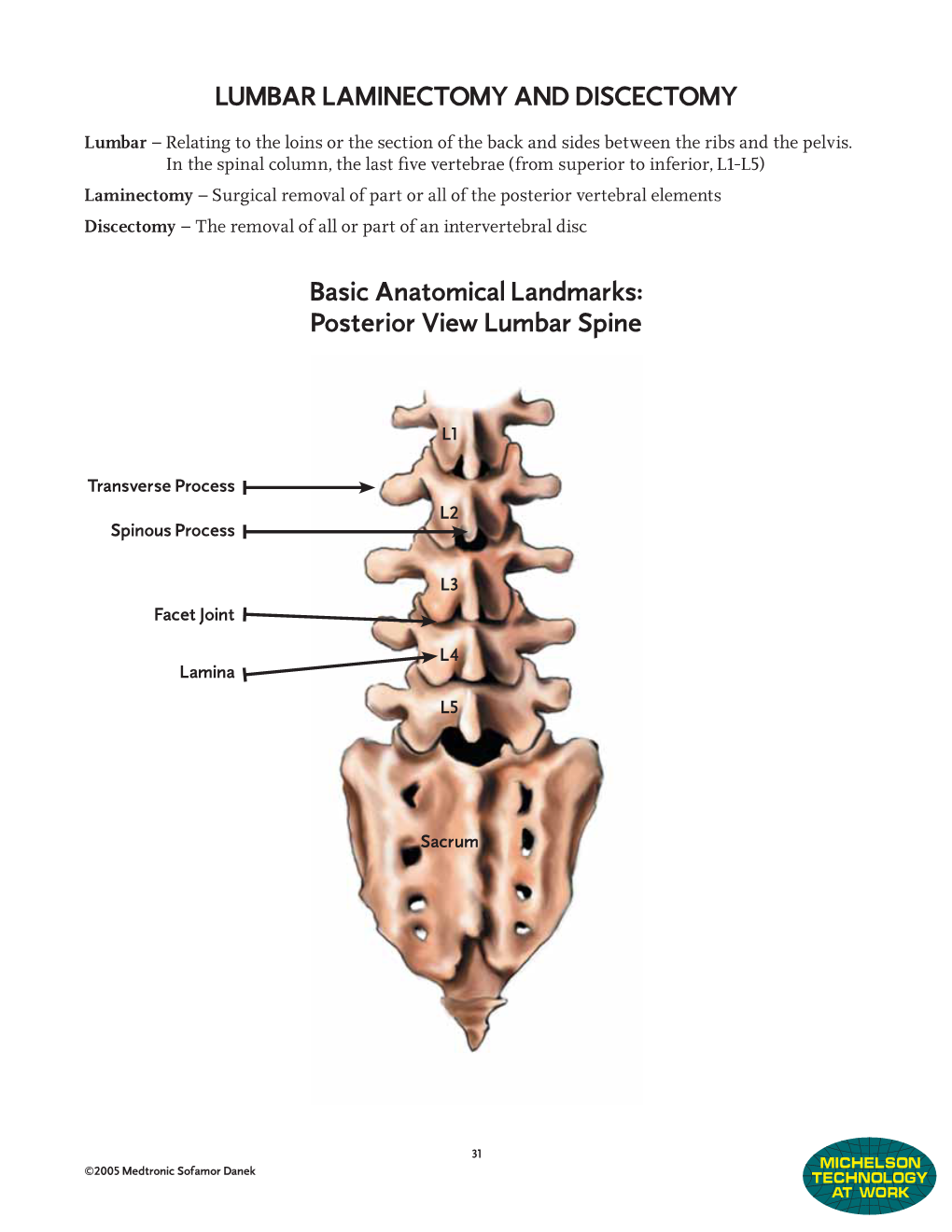 LUMBAR LAMINECTOMY and DISCECTOMY Basic Anatomical