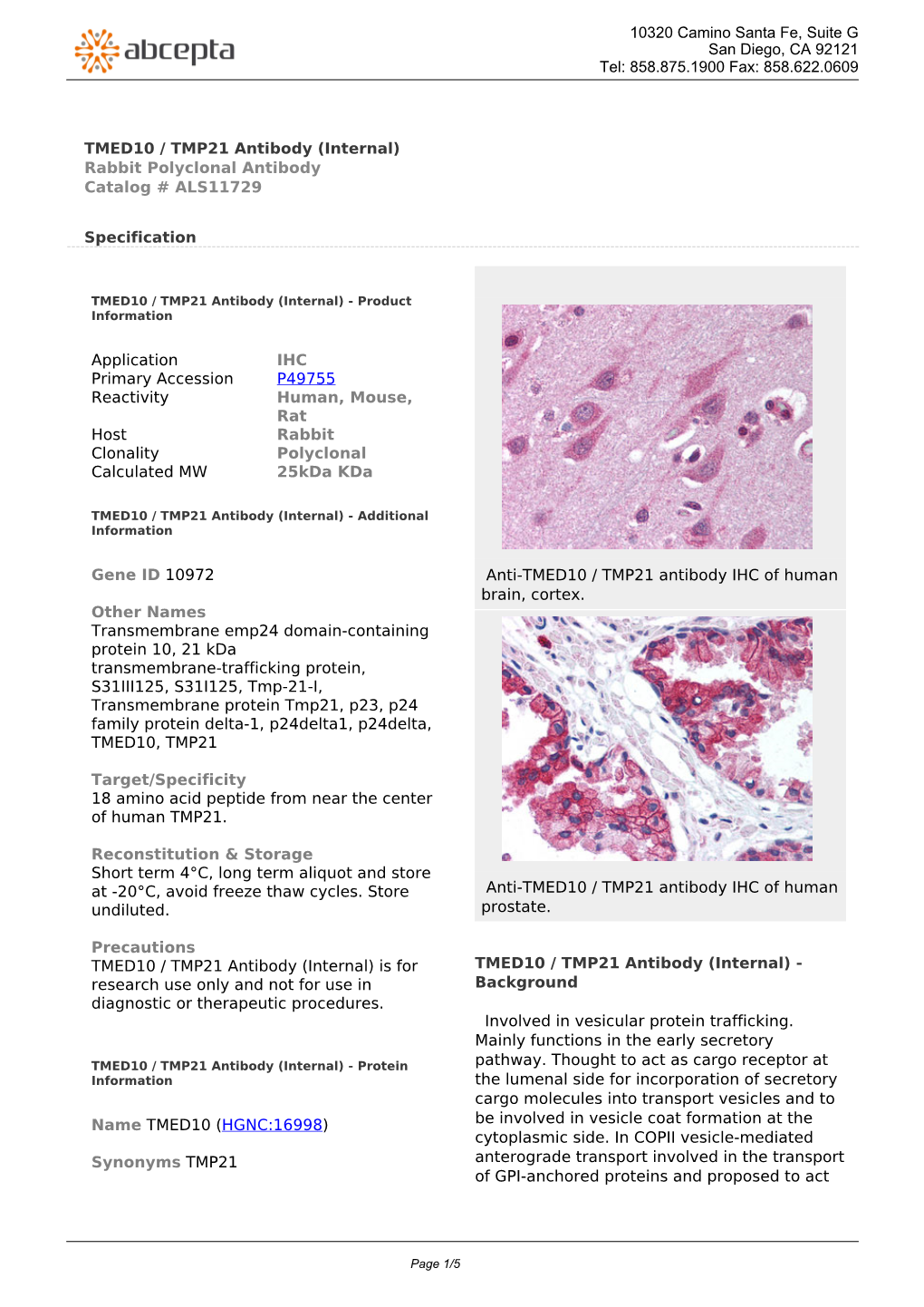 TMED10 / TMP21 Antibody (Internal) Rabbit Polyclonal Antibody Catalog # ALS11729