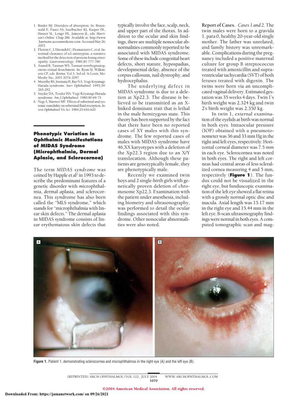 Phenotypic Variation in Ophthalmic Manifestations of MIDAS Syndrome