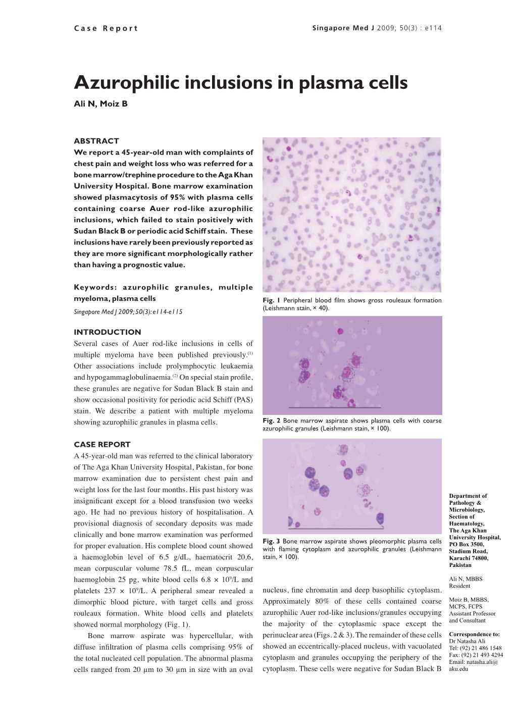 Azurophilic Inclusions in Plasma Cells Ali N, Moiz B