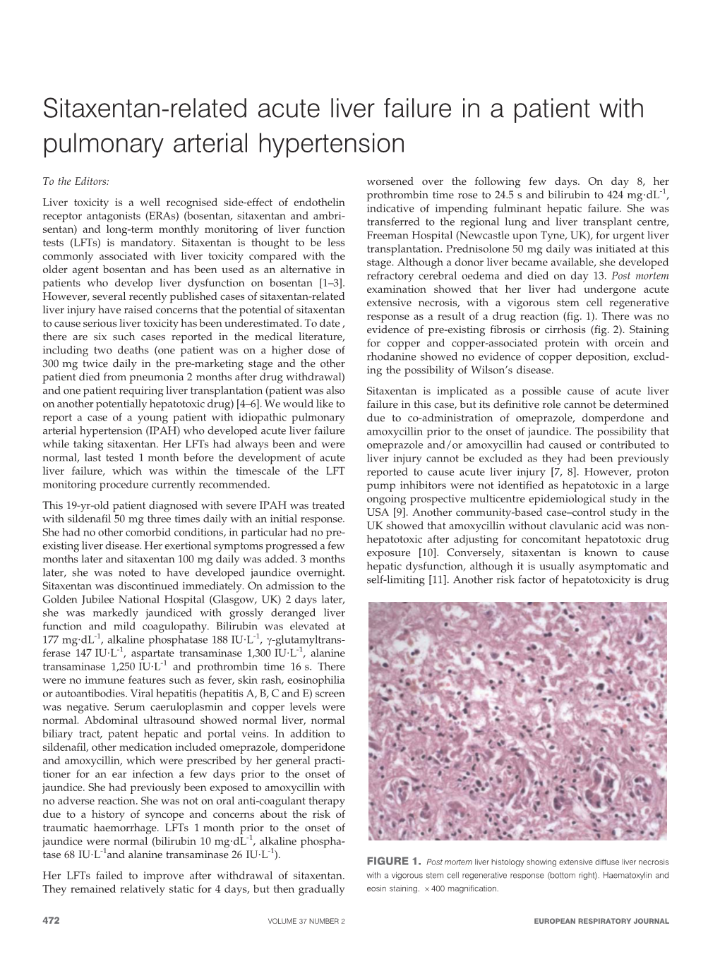 Sitaxentan-Related Acute Liver Failure in a Patient with Pulmonary Arterial Hypertension