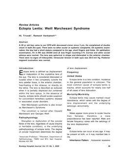 Ectopia Lentis: Weill Marchesani Syndrome