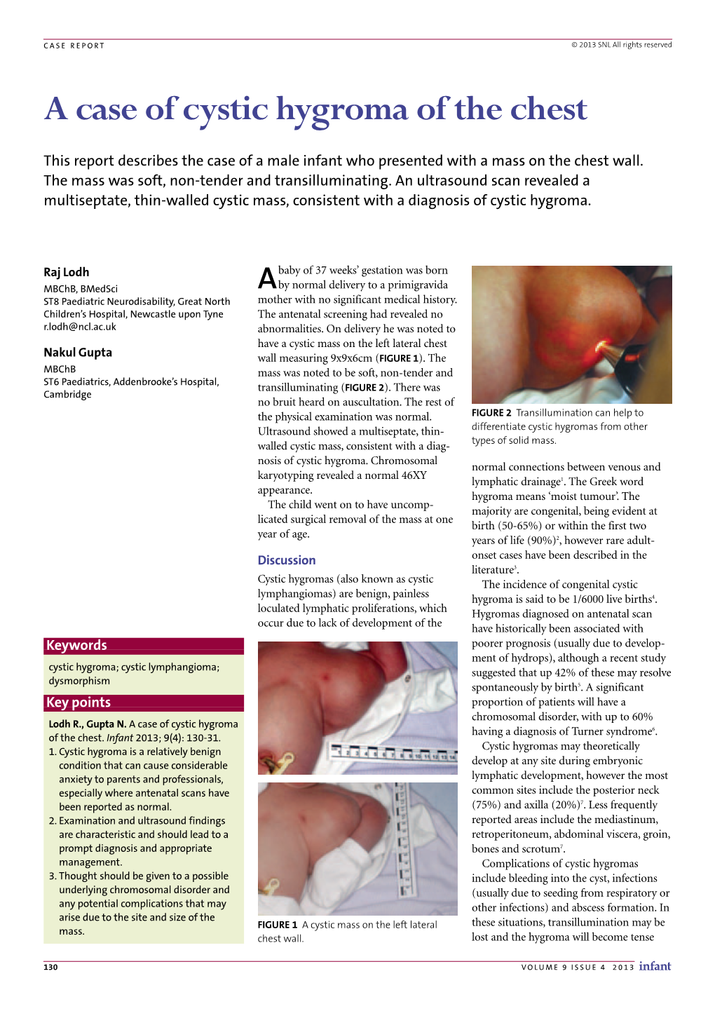 A Case of Cystic Hygroma of the Chest