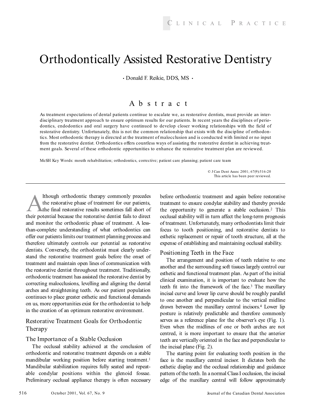 Orthodontically Assisted Restorative Dentistry