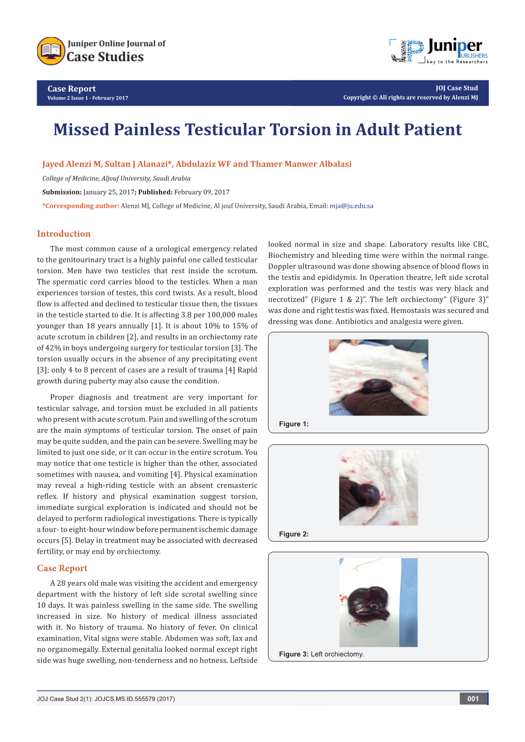 Missed Painless Testicular Torsion in Adult Patient