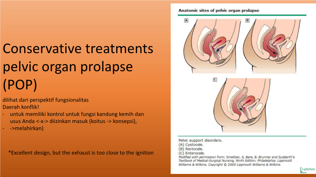 Conservative Treatments Pelvic Organ Prolapse (POP)