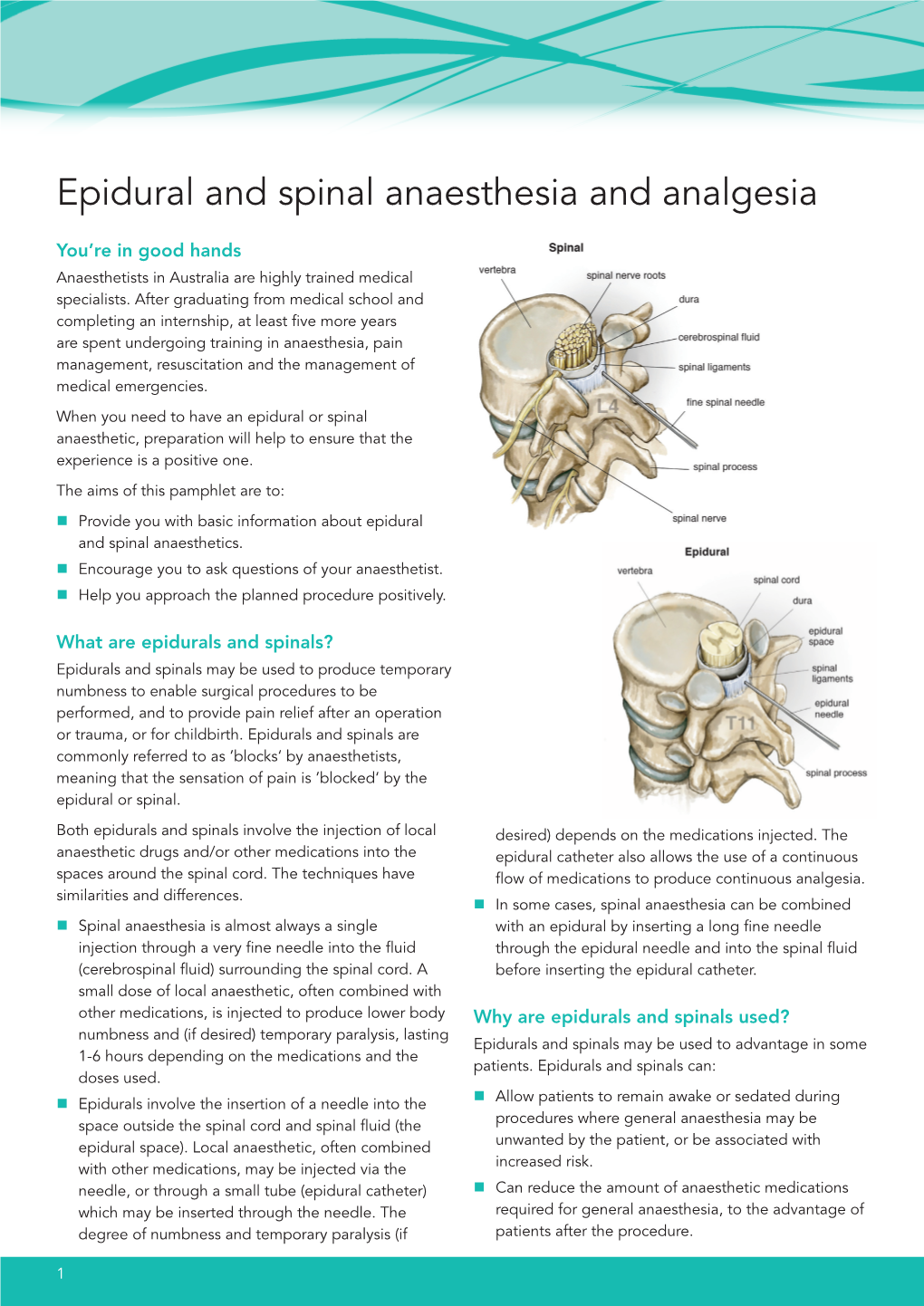 Epidural And Spinal Anaesthesia And Analgesia - DocsLib