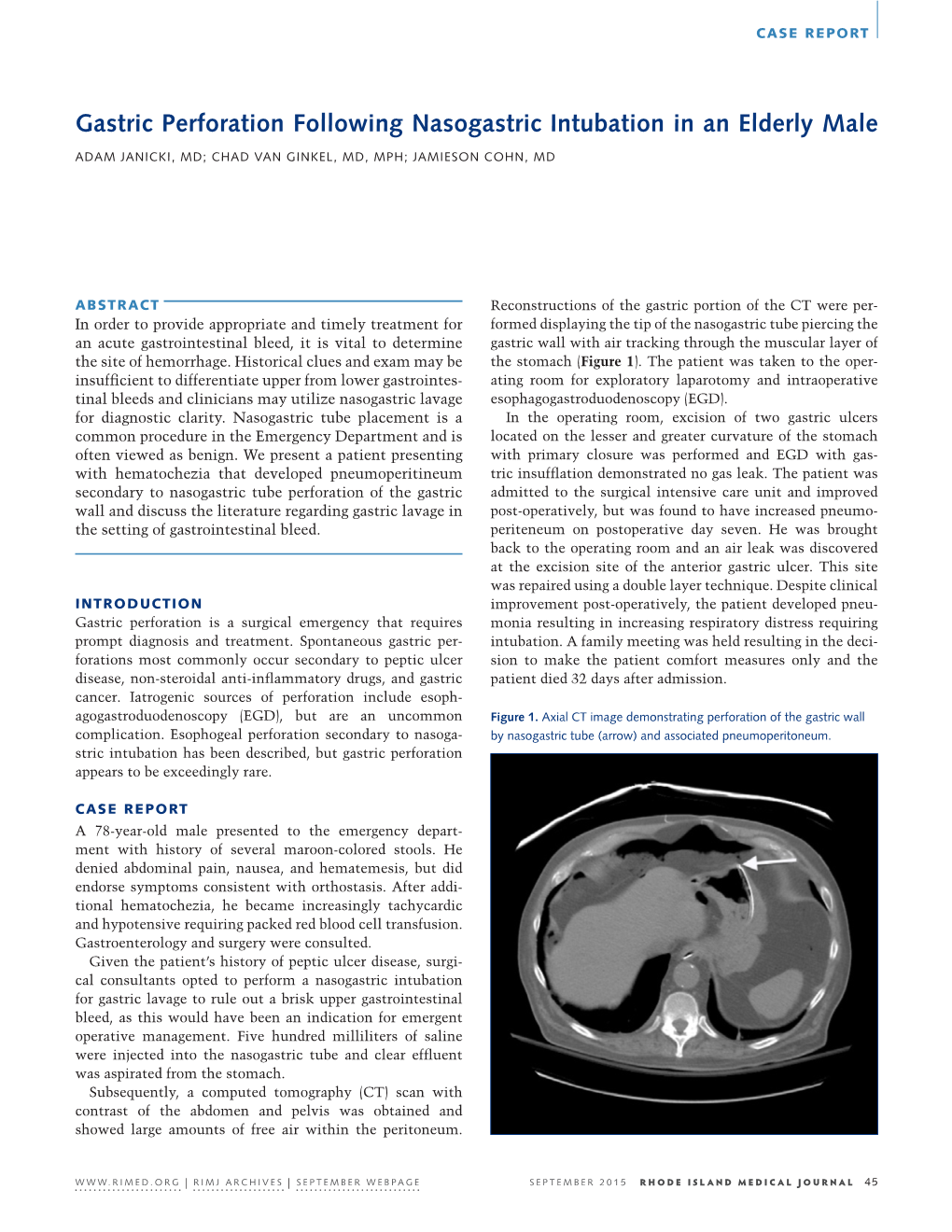 Gastric Perforation Following Nasogastric Intubation in an Elderly Male