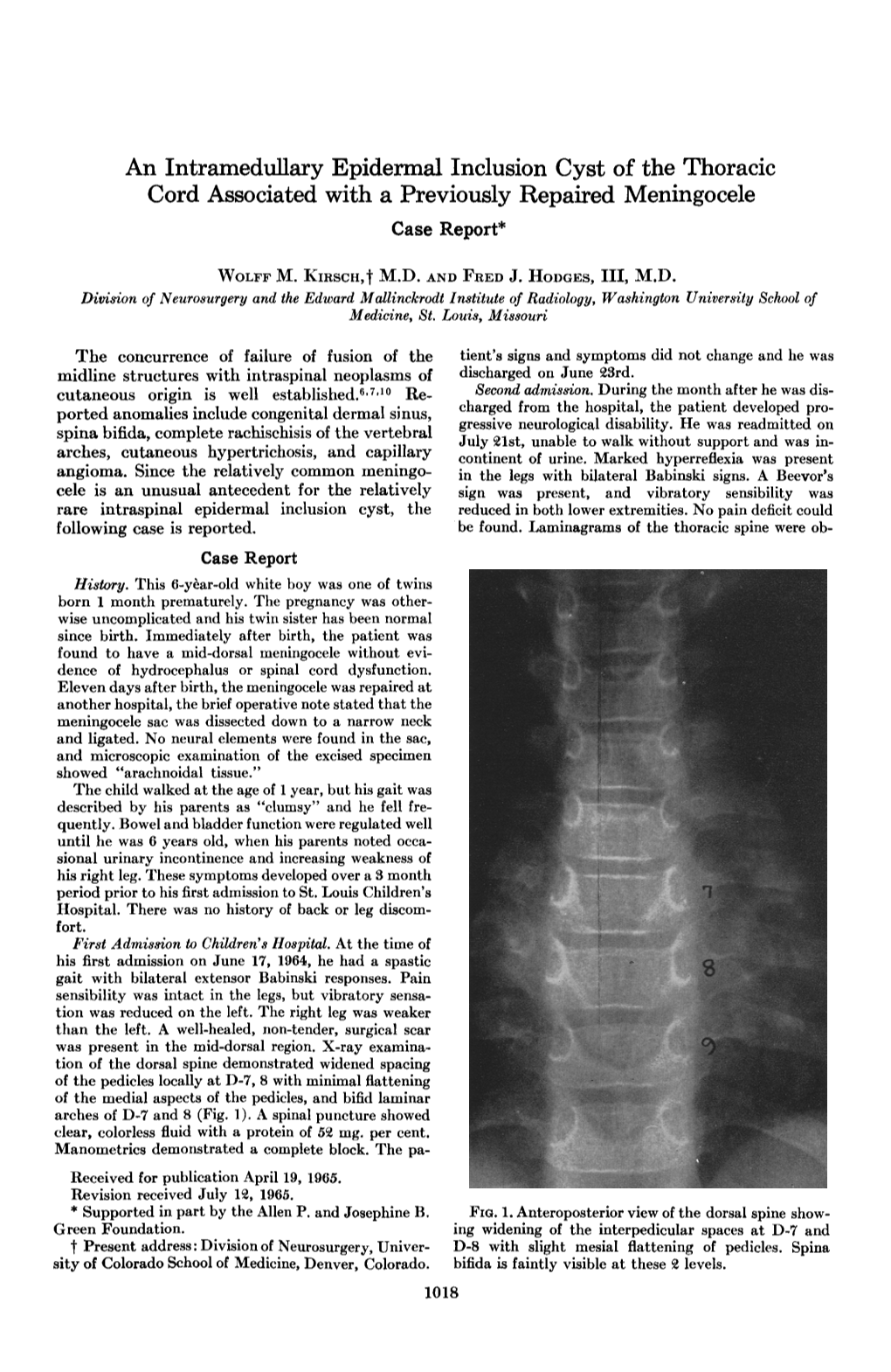 An Intramedullary Epidermal Inclusion Cyst of the Thoracic Cord ...