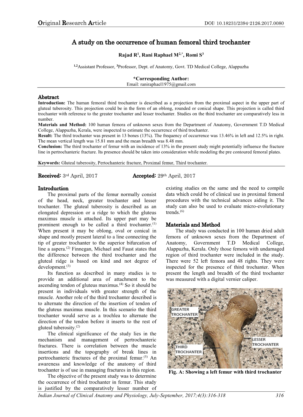 A Study on the Occurrence of Human Femoral Third Trochanter