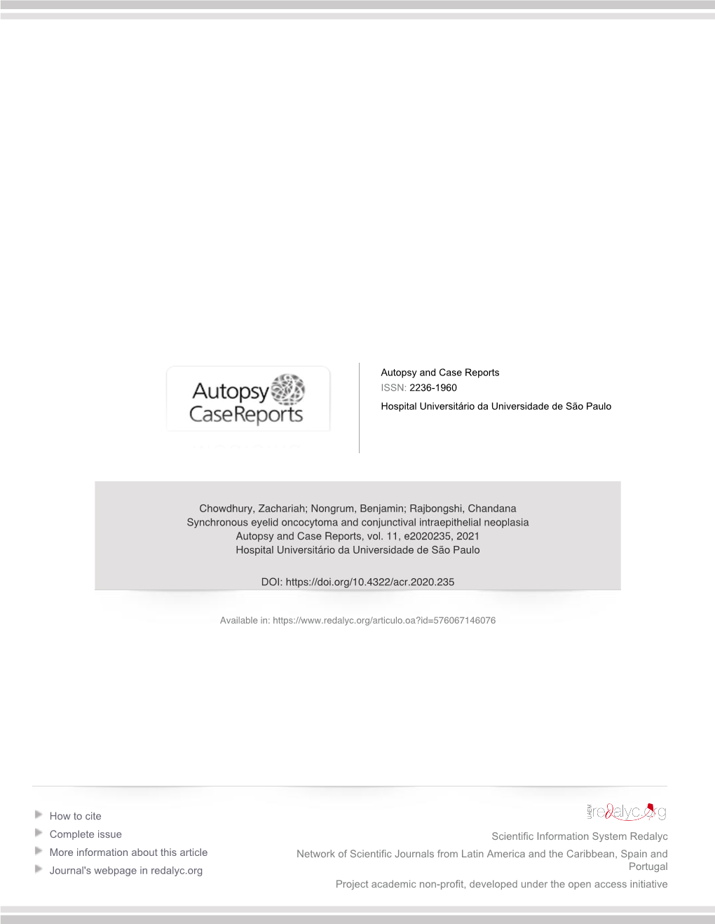 Synchronous Eyelid Oncocytoma and Conjunctival Intraepithelial Neoplasia Autopsy and Case Reports, Vol